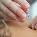 Acupuncturist in Portland